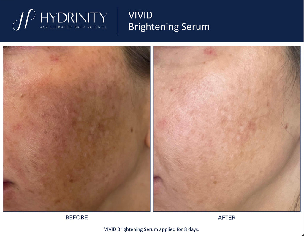 Vivid Brightening Serum