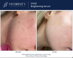 Vivid Brightening Serum