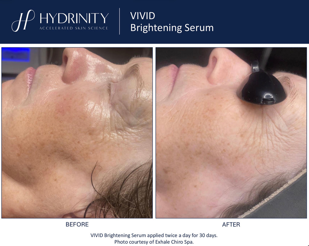 Vivid Brightening Serum
