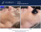 Vivid Brightening Serum