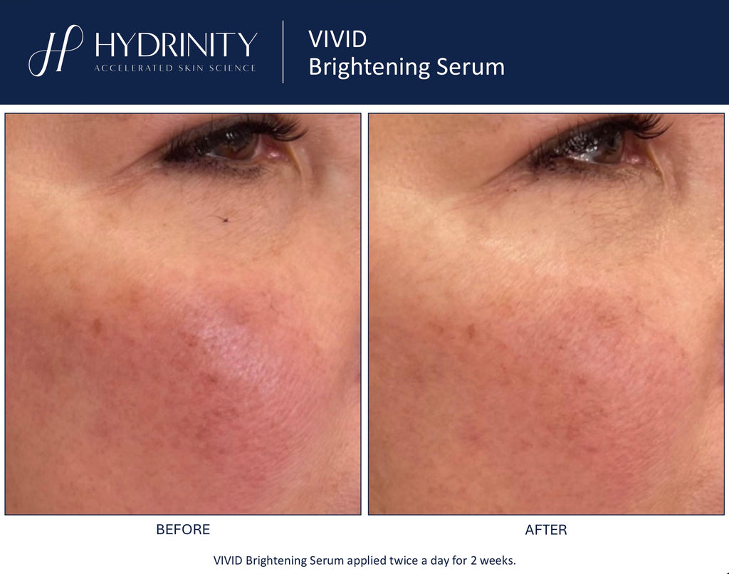 Vivid Brightening Serum