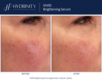 Vivid Brightening Serum