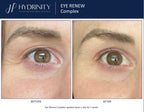 Eye Renew Complex