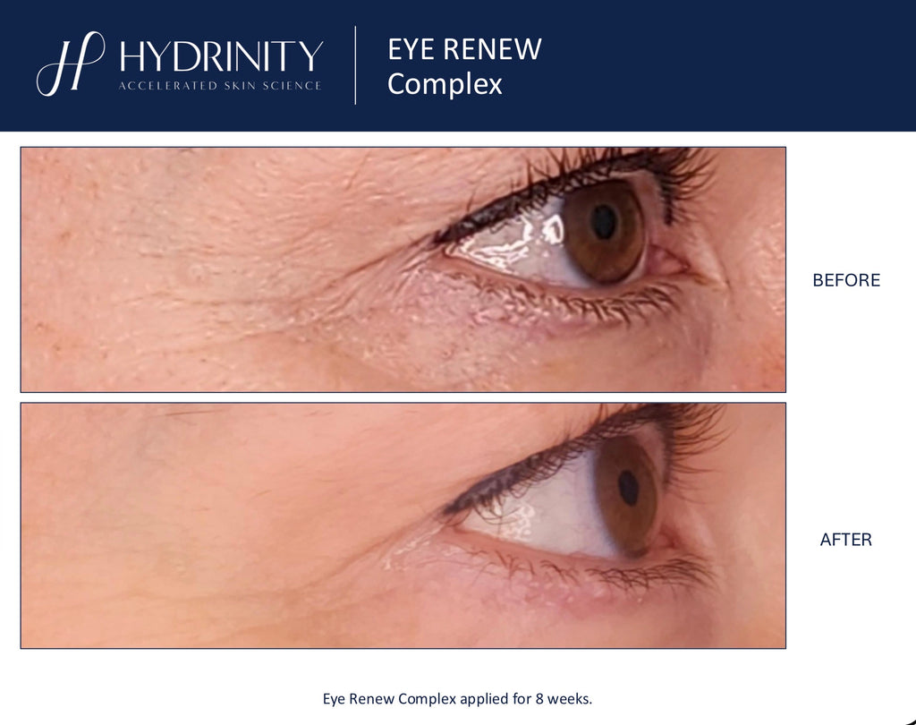 Eye Renew Complex